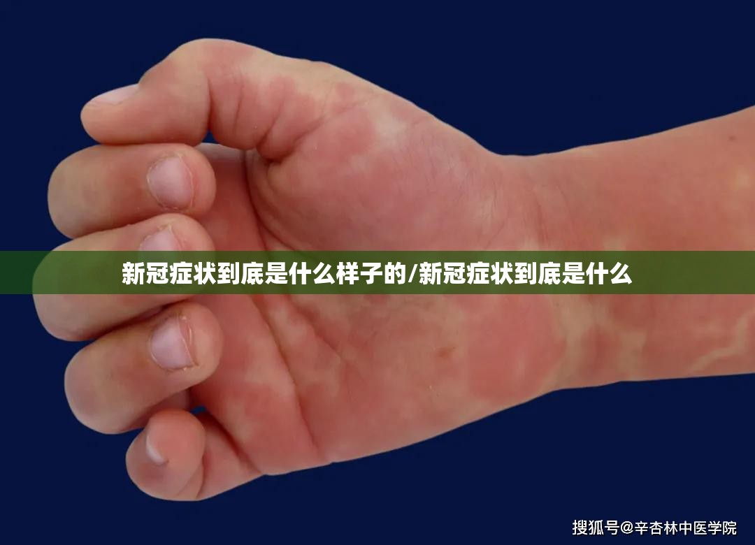 新冠症状到底是什么样子的/新冠症状到底是什么