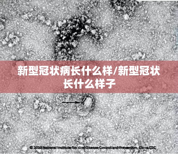 新型冠状病长什么样/新型冠状长什么样子