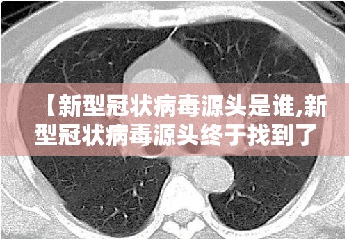 【新型冠状病毒源头是谁,新型冠状病毒源头终于找到了】