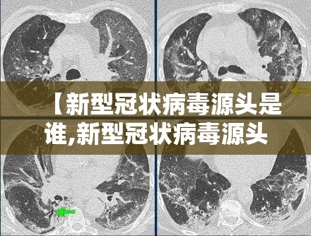 【新型冠状病毒源头是谁,新型冠状病毒源头终于找到了】