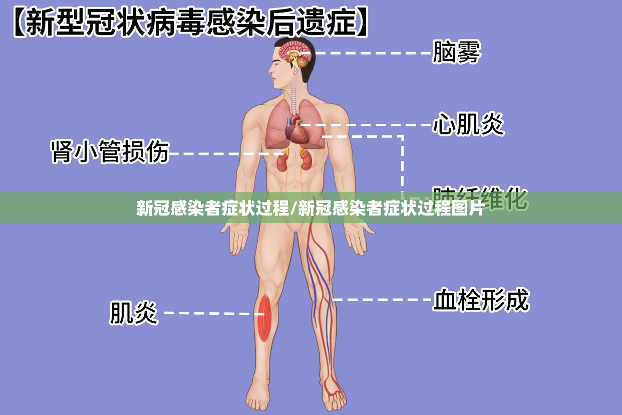 新冠感染者症状过程/新冠感染者症状过程图片