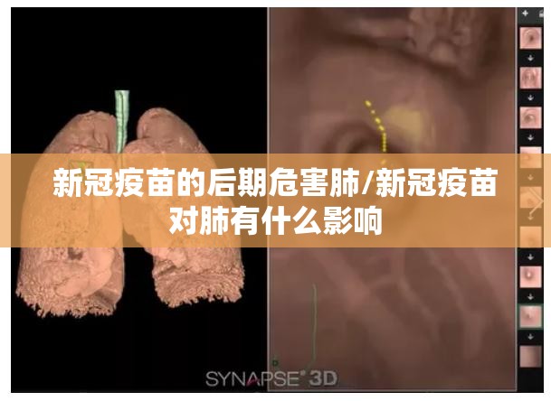 新冠疫苗的后期危害肺/新冠疫苗对肺有什么影响