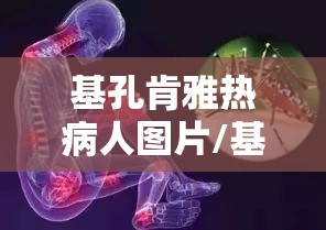 基孔肯雅热病人图片/基孔亚病毒