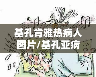 基孔肯雅热病人图片/基孔亚病毒