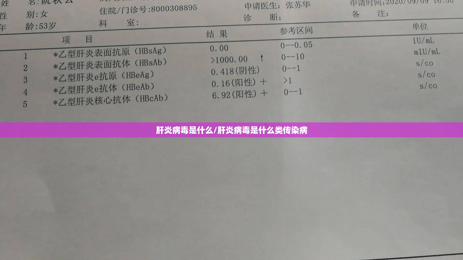 肝炎病毒是什么/肝炎病毒是什么类传染病