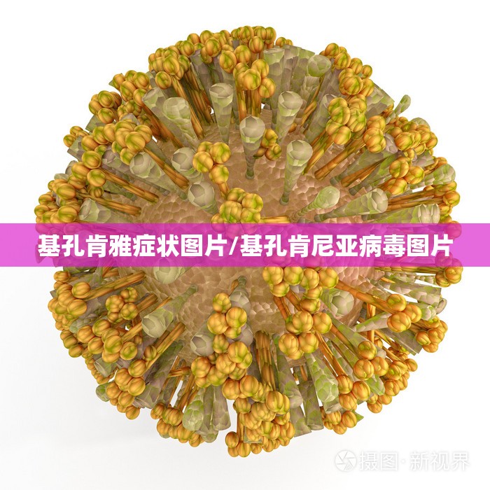 基孔肯雅症状图片/基孔肯尼亚病毒图片