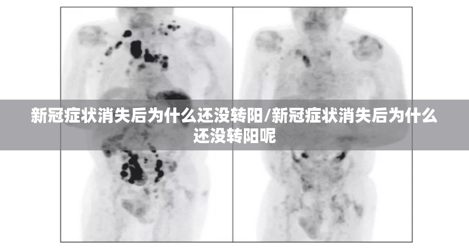新冠症状消失后为什么还没转阳/新冠症状消失后为什么还没转阳呢