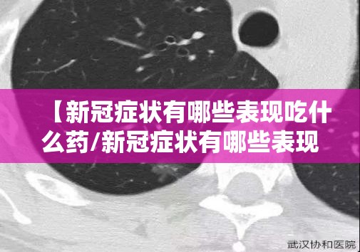 【新冠症状有哪些表现吃什么药/新冠症状有哪些表现吃什么药好】