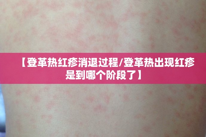 【登革热红疹消退过程/登革热出现红疹是到哪个阶段了】