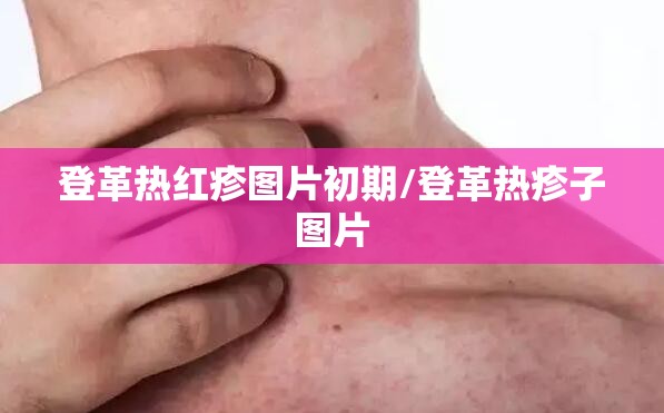登革热红疹图片初期/登革热疹子图片