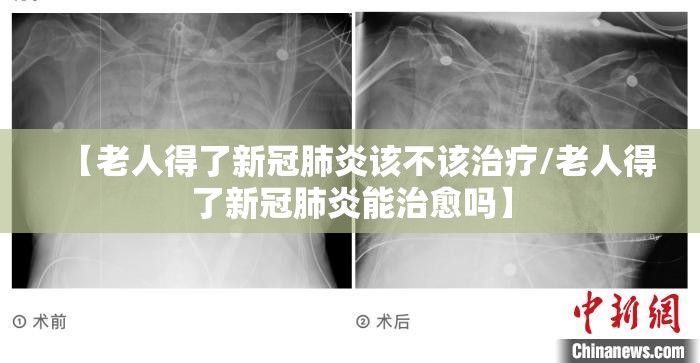 【老人得了新冠肺炎该不该治疗/老人得了新冠肺炎能治愈吗】