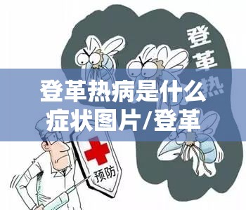 登革热病是什么症状图片/登革热的早期症状