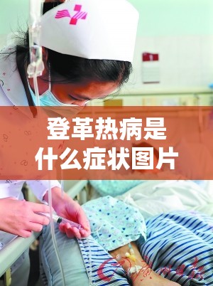 登革热病是什么症状图片/登革热的早期症状