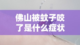 佛山被蚊子咬了是什么症状/被蚊子咬佛教