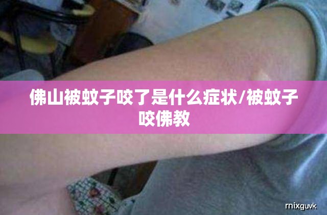 佛山被蚊子咬了是什么症状/被蚊子咬佛教