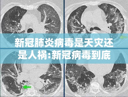 新冠肺炎病毒是天灾还是人祸:新冠病毒到底是天灾还是人祸