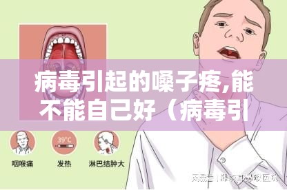 病毒引起的嗓子疼,能不能自己好（病毒引发嗓子疼）