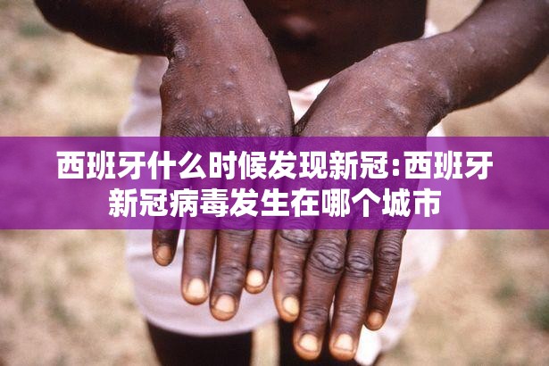 西班牙什么时候发现新冠:西班牙新冠病毒发生在哪个城市