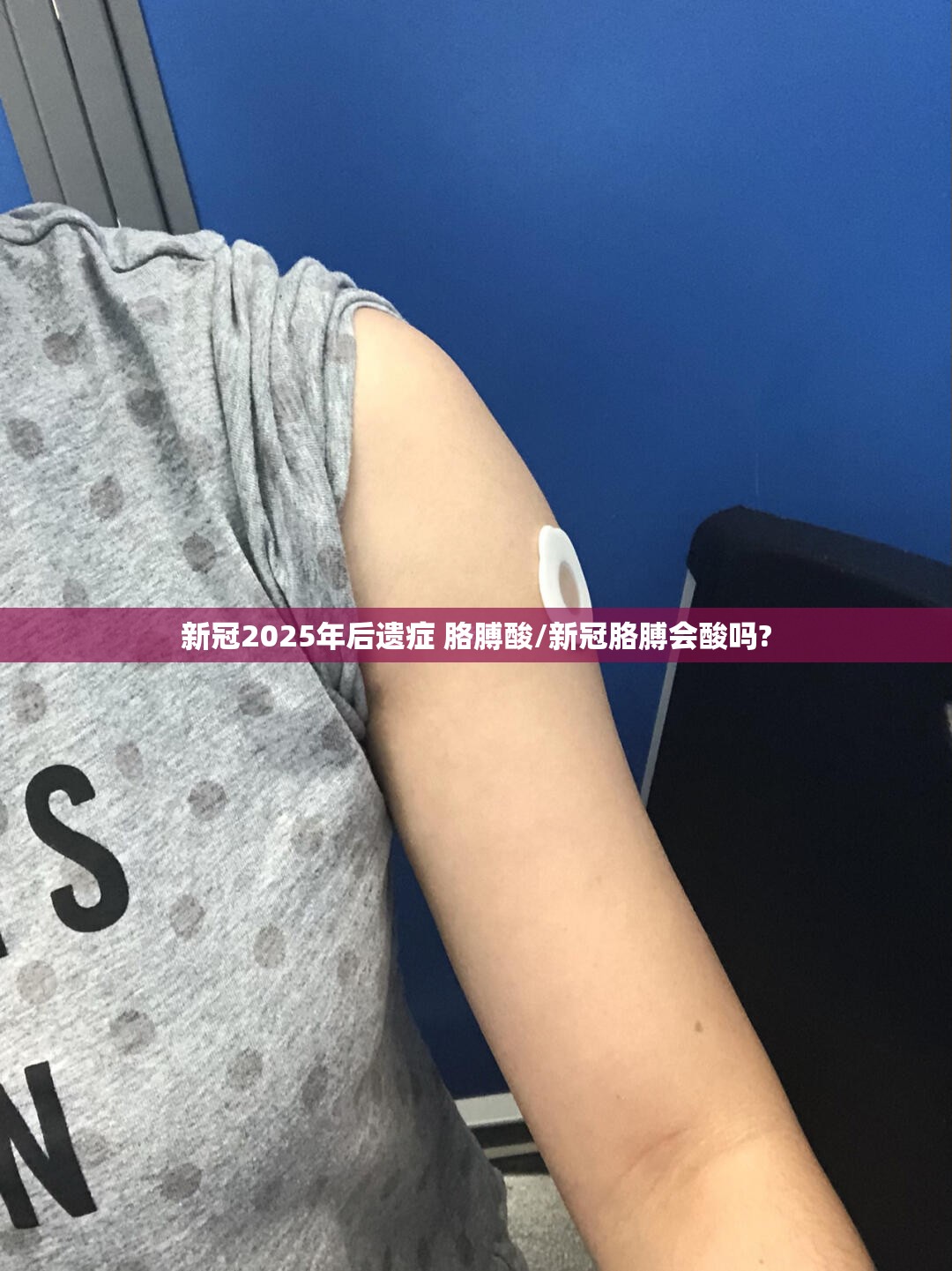 新冠2025年后遗症 胳膊酸/新冠胳膊会酸吗?