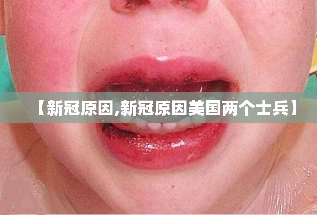 【新冠原因,新冠原因美国两个士兵】