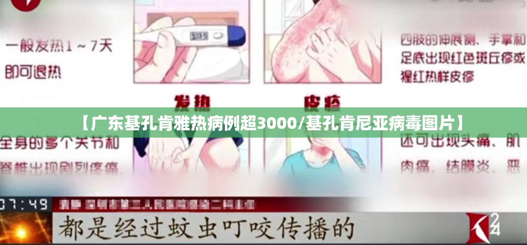 【广东基孔肯雅热病例超3000/基孔肯尼亚病毒图片】