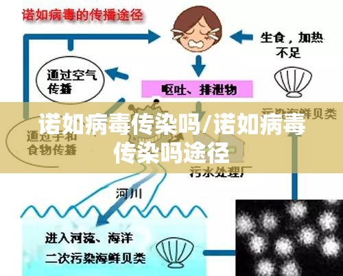 诺如病毒传染吗/诺如病毒传染吗途径