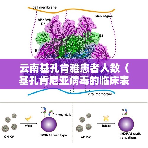 云南基孔肯雅患者人数（基孔肯尼亚病毒的临床表现）
