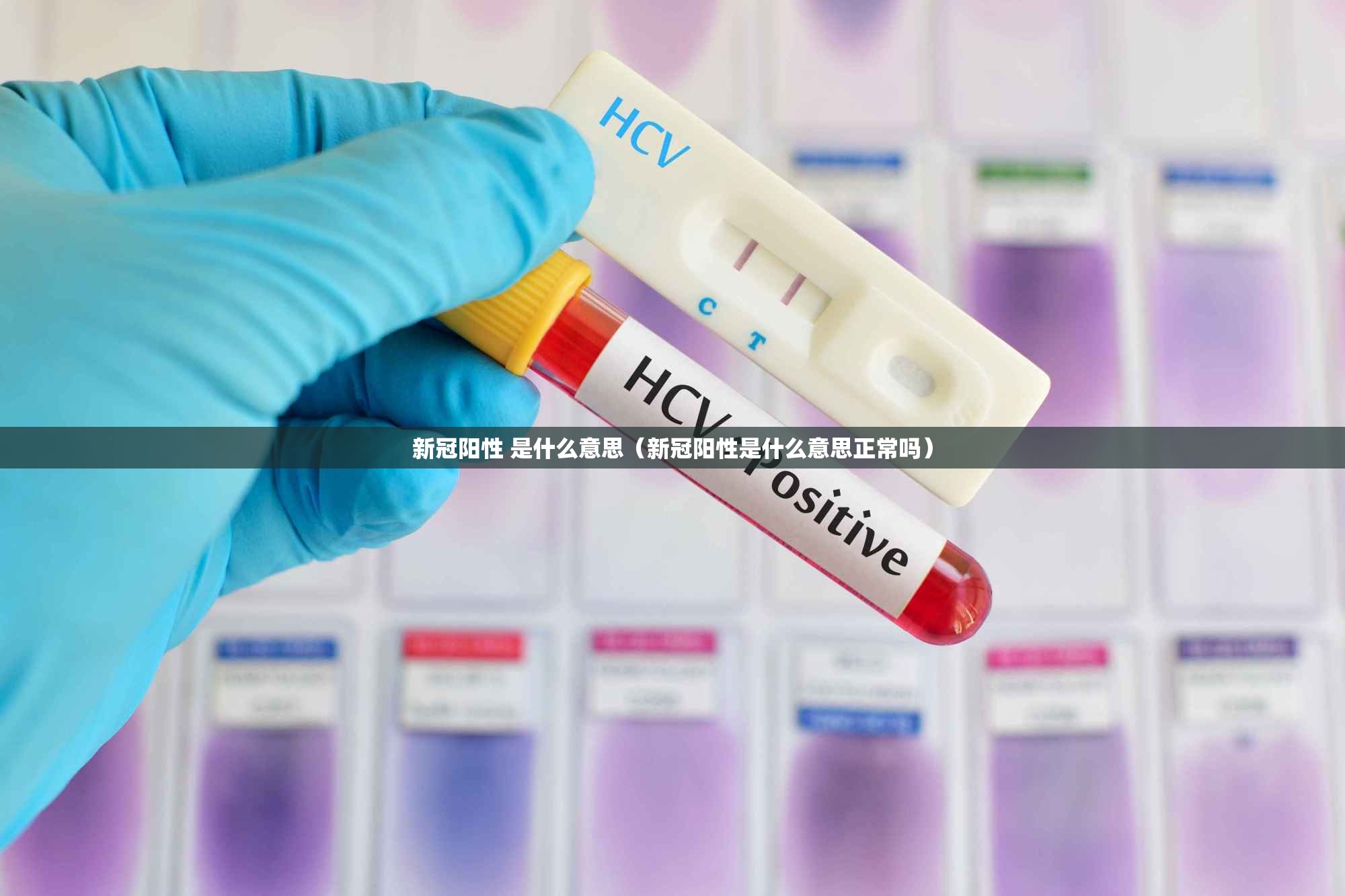 新冠阳性 是什么意思（新冠阳性是什么意思正常吗）