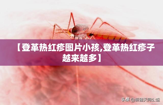 【登革热红疹图片小孩,登革热红疹子越来越多】