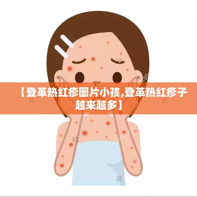 【登革热红疹图片小孩,登革热红疹子越来越多】