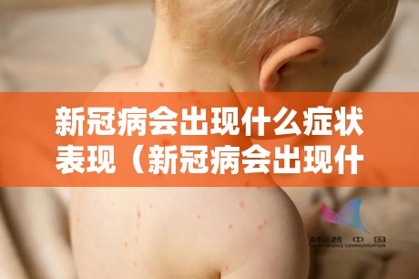 新冠病会出现什么症状表现（新冠病会出现什么症状表现呢）