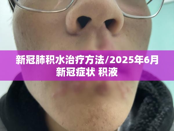 新冠肺积水治疗方法/2025年6月新冠症状 积液
