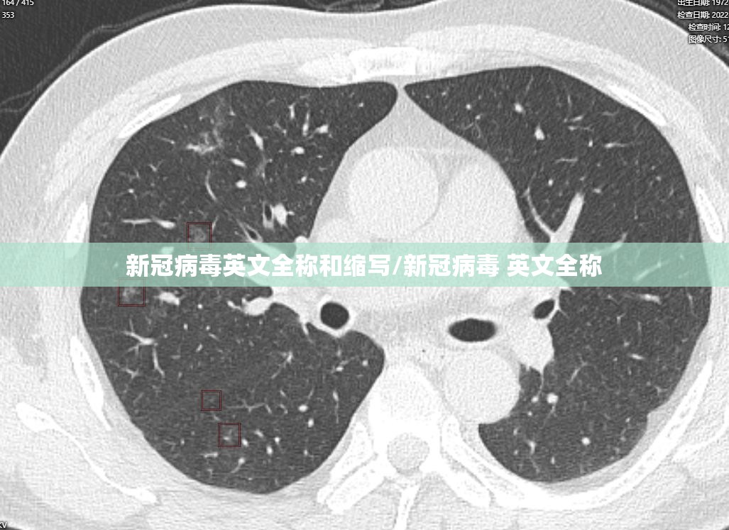 新冠病毒英文全称和缩写/新冠病毒 英文全称