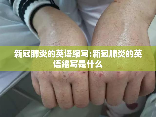新冠肺炎的英语缩写:新冠肺炎的英语缩写是什么