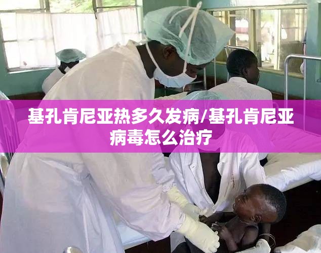 基孔肯尼亚热多久发病/基孔肯尼亚病毒怎么治疗