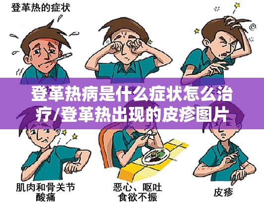 登革热病是什么症状怎么治疗/登革热出现的皮疹图片