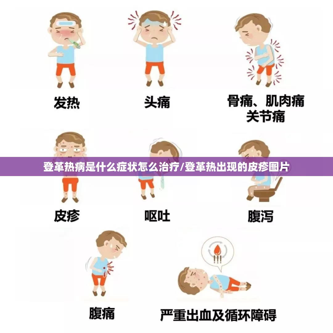 登革热病是什么症状怎么治疗/登革热出现的皮疹图片