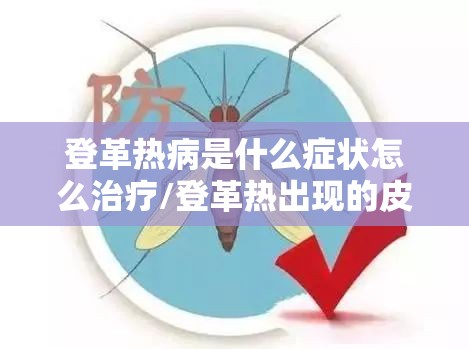 登革热病是什么症状怎么治疗/登革热出现的皮疹图片