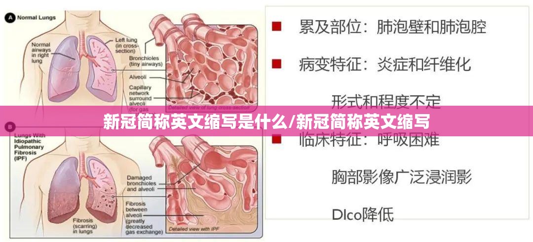 新冠简称英文缩写是什么/新冠简称英文缩写