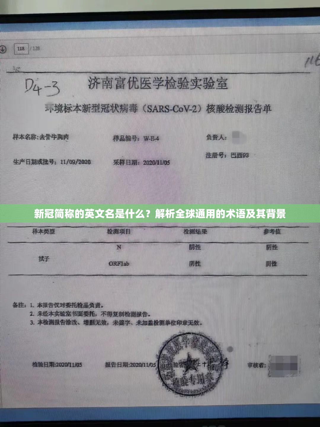 新冠简称的英文名是什么？解析全球通用的术语及其背景