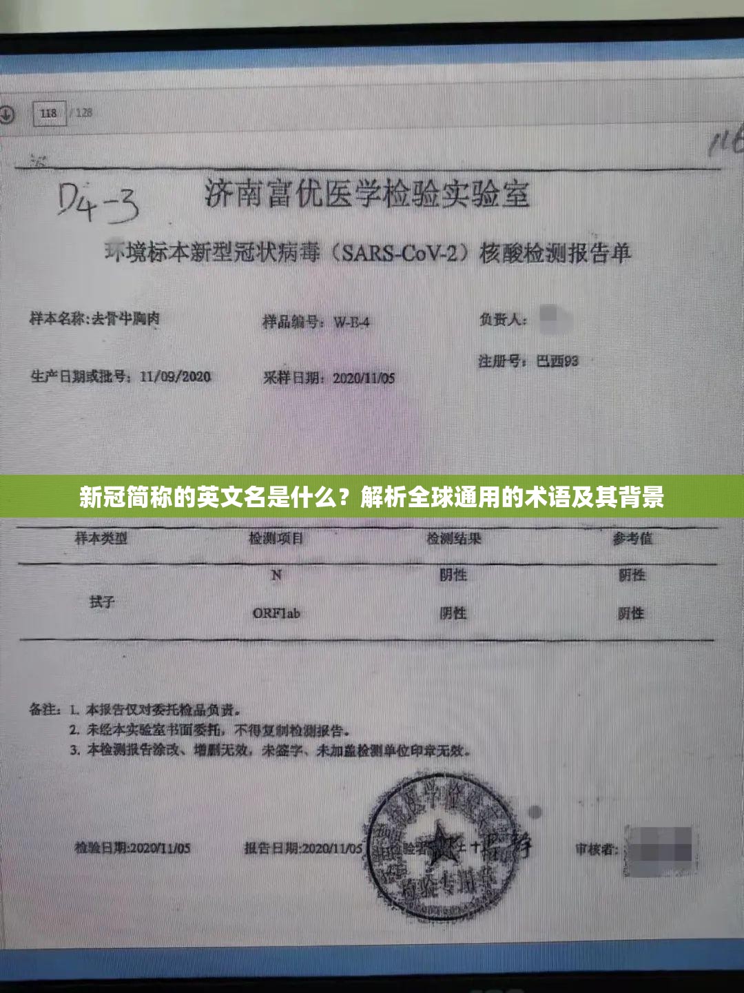 新冠简称的英文名是什么？解析全球通用的术语及其背景