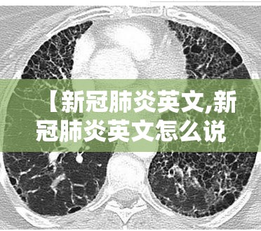【新冠肺炎英文,新冠肺炎英文怎么说】