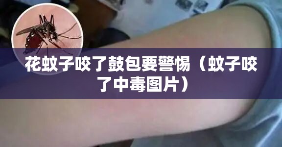 花蚊子咬了鼓包要警惕（蚊子咬了中毒图片）