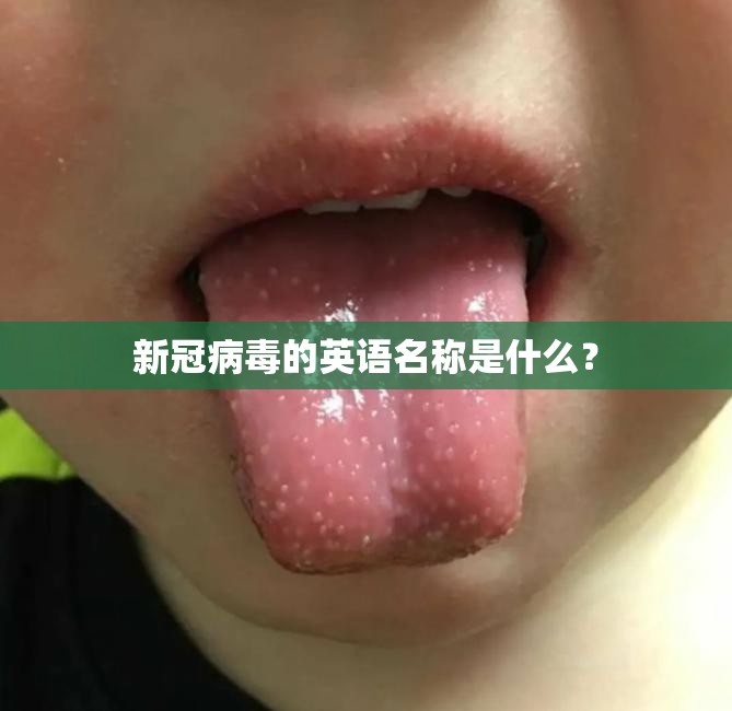 新冠病毒的英语名称是什么？