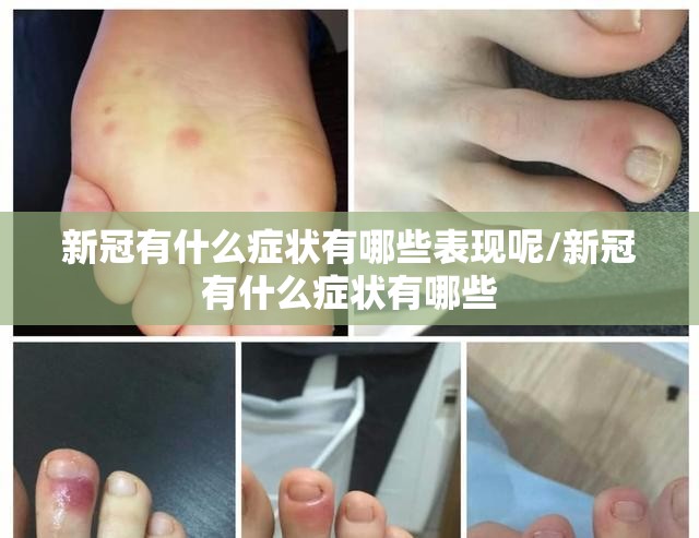 新冠有什么症状有哪些表现呢/新冠有什么症状有哪些