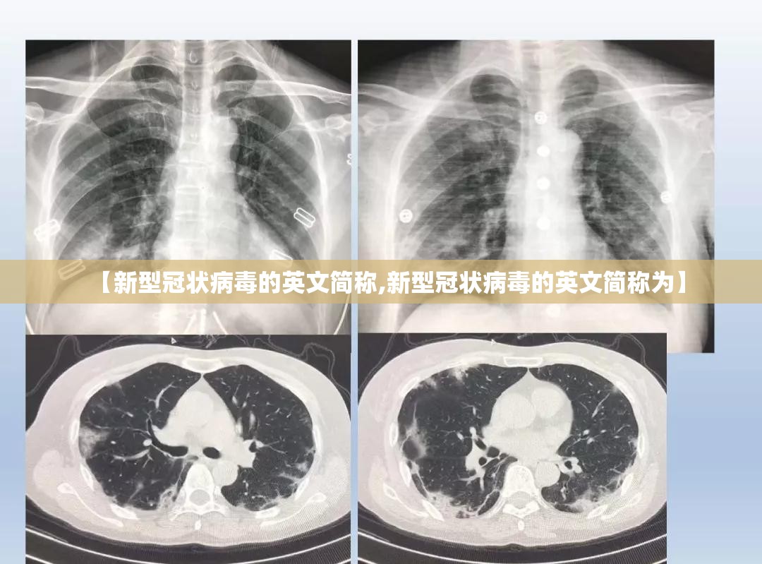 【新型冠状病毒的英文简称,新型冠状病毒的英文简称为】