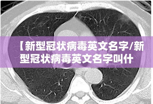 【新型冠状病毒英文名字/新型冠状病毒英文名字叫什么】