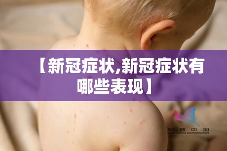 【新冠症状,新冠症状有哪些表现】