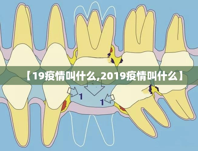 【19疫情叫什么,2019疫情叫什么】