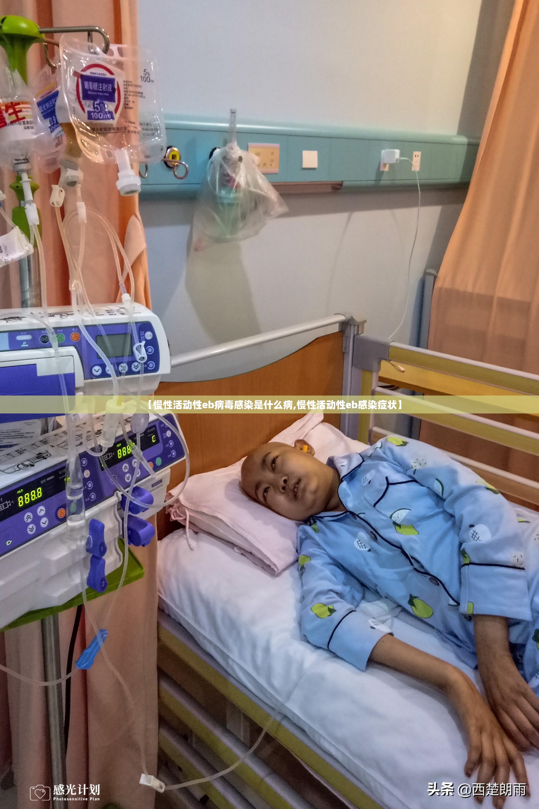 【慢性活动性eb病毒感染是什么病,慢性活动性eb感染症状】
